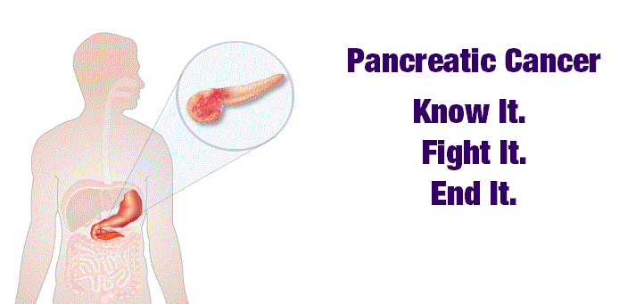 What you should know about pancreatic cancer