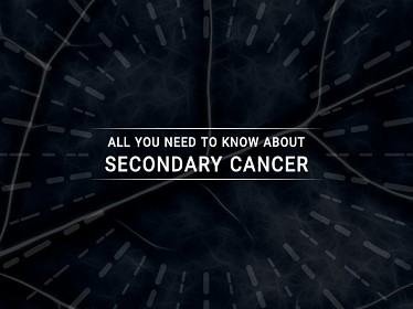 All You Need to Know About Secondary Cancer