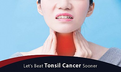 Tonsil Cancer 