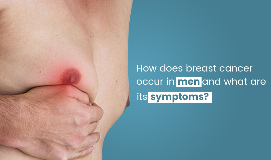 Breast Cancer in Men