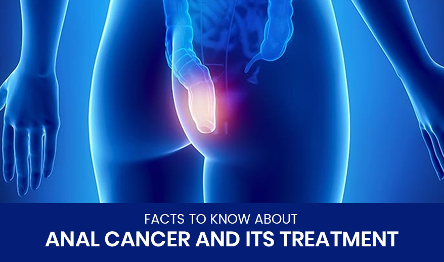 Facts to Know About Anal Cancer and Its Treatment