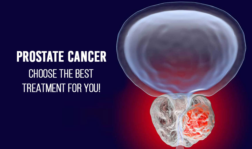 Prostate cancer : Choose the best treatment for you