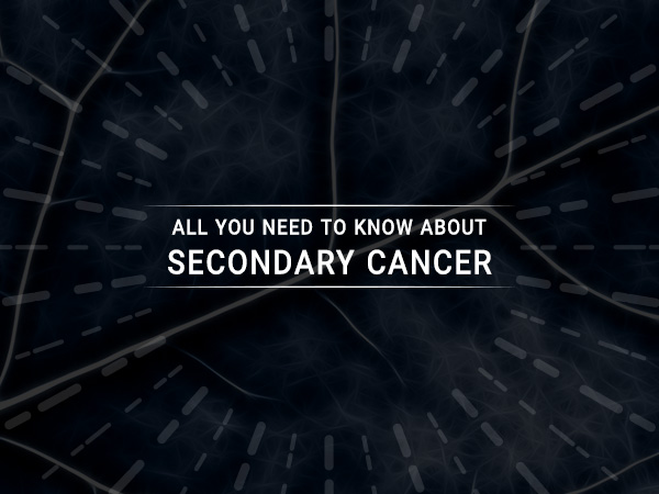All You Need to Know About Secondary Cancer