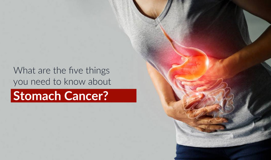 What are the five things you need to know about stomach cancer?