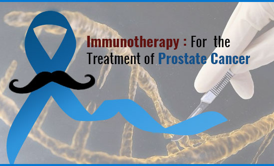 Immunotherapy For the Treatment of Prostate Cancer