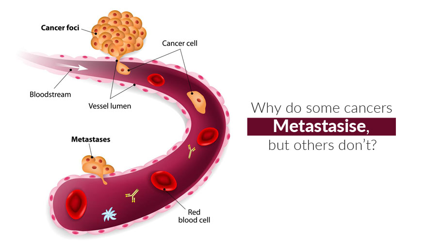 Why do some cancers metastasis but others donâ€™t?