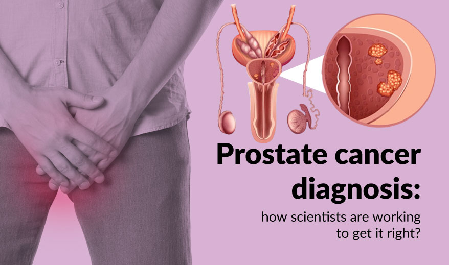 Prostate Cancer Diagnosis: How scientists are working to get it right?