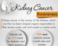 Kidney cancer treatment - Newsletter